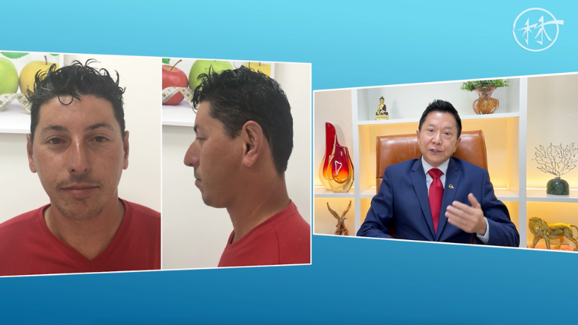 A regeneração com células-tronco é um novo caminho para rejuvenescimento, explica Dr. Milton Seigi Hayashi.